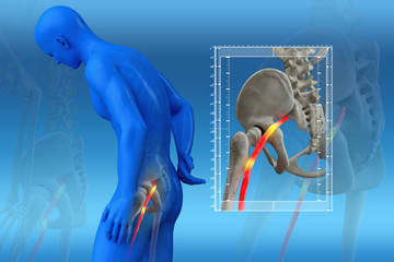 " Fisioterapia amanos ciática - Castro Urdiales"