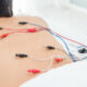 "fisioterapeuta amanos castro urdiales acupuntura electropuncion neuromodulacion"
